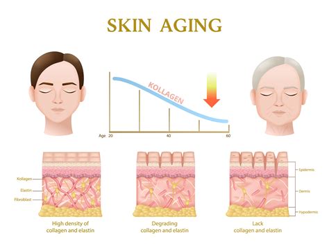 A graphic illustrating the aging process of skin, showing collagen depletion and the formation of wrinkles.
