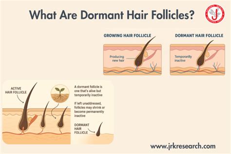 Illustration showing a comparison of healthy hair follicles and dormant hair follicles stimulated by growth serum.