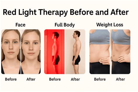 Comparison of before and after photos demonstrating cellulite reduction after consistent red light therapy, with clear markers for progress tracking.