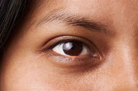 Close-up image showing the texture of skin around the eye area, highlighting concerns like dark circles and fine lines.