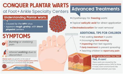 Infographic comparing different professional plantar wart treatments, highlighting their mechanisms and typical outcomes.