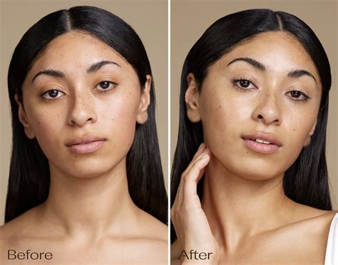 Side-by-side comparison images showing the effect of tinted versus non-tinted sunscreen on hyperpigmented skin.