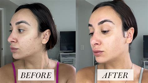 Collage of images showcasing healthy skin, before-and-after results of cosmetic treatments, and dermatological tools