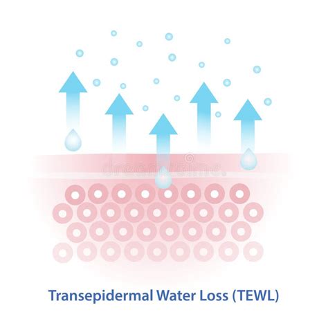 Infographic explaining Trans-Epidermal Water Loss (TEWL)