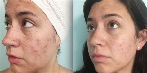 A split image showing before and after hair treated with a clay mask, highlighting improved texture and shine.