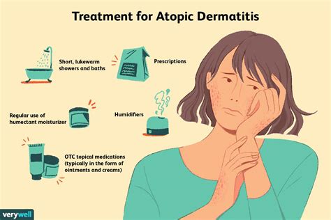 Infographic comparing different treatment options for atopic dermatitis