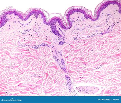 histology of rat skin showing collagen structure