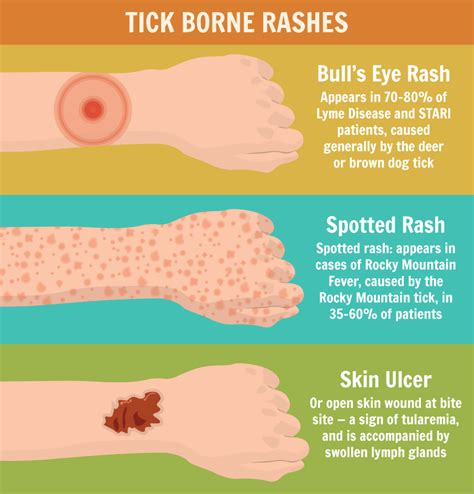 Diagram illustrating the different types of rashes associated with tick-borne illnesses.