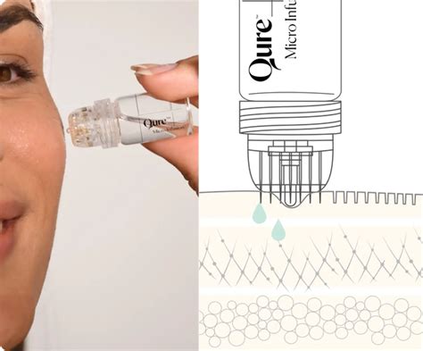 Diagram showing the step-by-step process of using the Qure Micro-Infusion System.