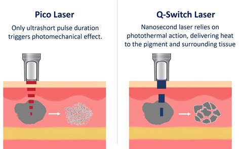 Diagram illustrating the picosecond pulse delivery mechanism of a Pico Laser compared to nanosecond pulses.