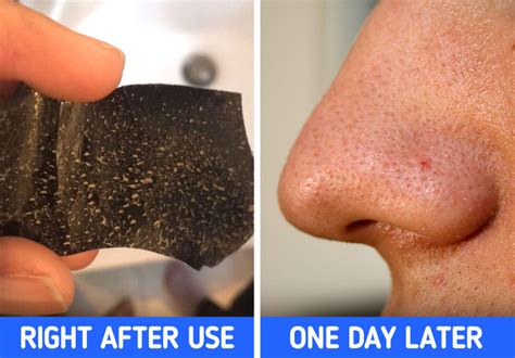 comparison of before and after results of using pore strips