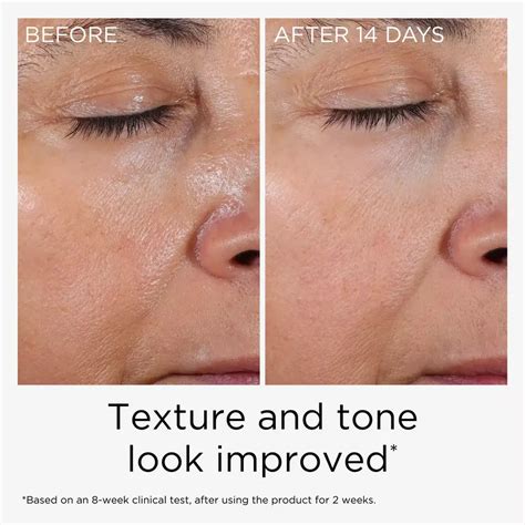 A split image showing before and after results of skin treated with the cleanser, highlighting reduced wrinkles and dark spots.
