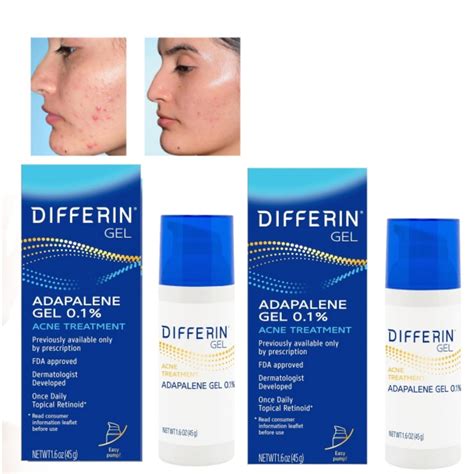 A chart illustrating the typical timeline of acne reduction and potential purging with Differin use over 12 weeks.