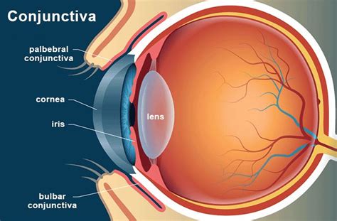 Illustration of the layers of the eye, highlighting the conjunctiva and sclera, to show where a subconjunctival hemorrhage occurs.
