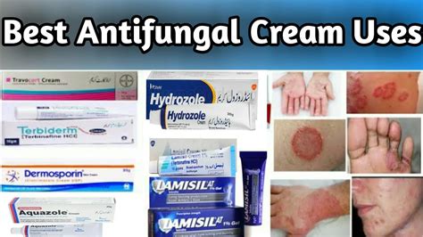 Illustration of various types of topical antifungal creams and their application