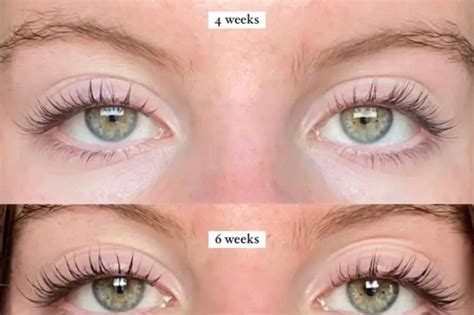 Before and after comparison photos of lashes after using the serum