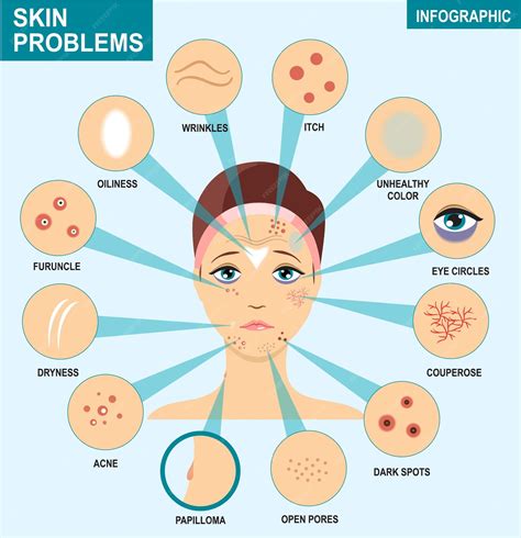 Infographic showing common skincare concerns like acne, dryness, oiliness, and aging.