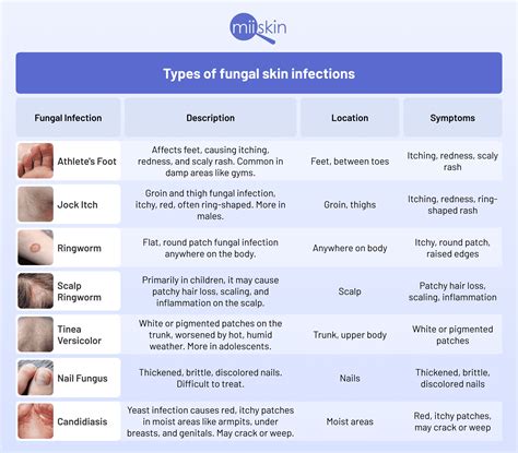A comparison table of different types of antifungal soaps.