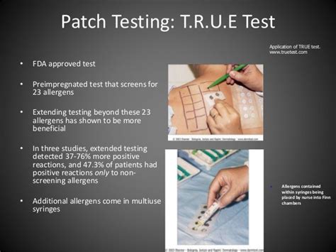 Illustration of a patch test being applied to a patient's back to identify allergens causing contact dermatitis.