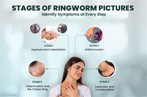 Diagram illustrating typical ringworm lesions on a cat's body, highlighting areas of hair loss and skin irritation