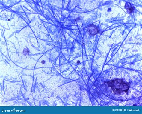 Microscopic view of fungal hyphae and arthrospores on a cat's hair shaft
