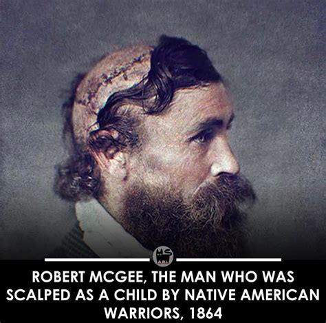 A historical photograph of Robert McGee, a scalping survivor, displaying his scars.