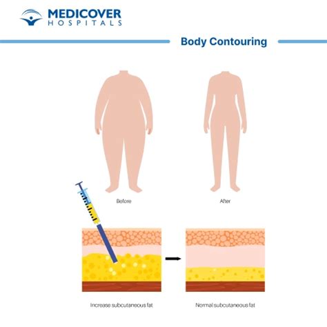 Diagram illustrating common body contouring surgical procedures like tummy tuck, arm lift, and thigh lift.
