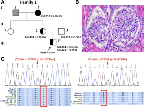 Diagram illustrating the genetic mutations in COL4A4 leading to Alport syndrome and thin basement membrane nephropathy