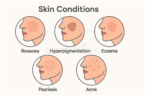 Illustration of various common skin conditions like acne, psoriasis, and rosacea.