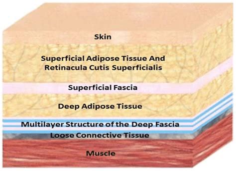 Diagram illustrating the layers of fascia in the skin and subcutaneous tissue, highlighting the potential areas targeted by fascia blasting tools and the retinaculae implicated in cellulite.