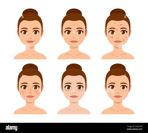 Illustration of different facial skin concerns like wrinkles, acne, and dark spots.