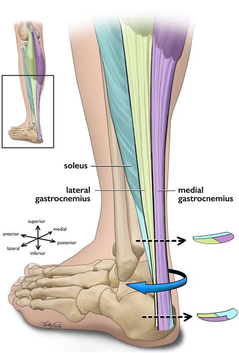 Illustration of the Achilles tendon and surrounding ankle anatomy, highlighting potential rupture sites.
