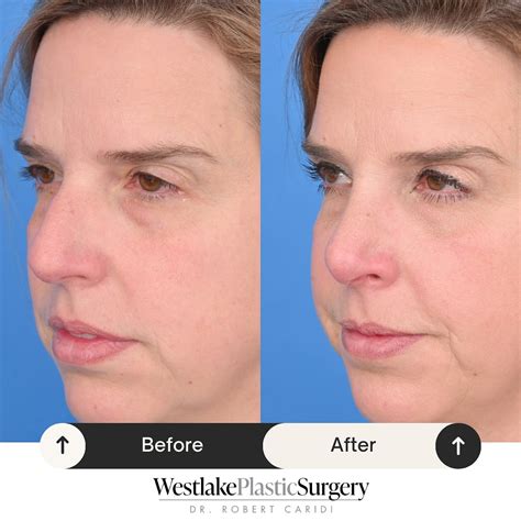 A collage of images showcasing various dermatological and plastic surgery procedures offered at Westlake Dermatology.
