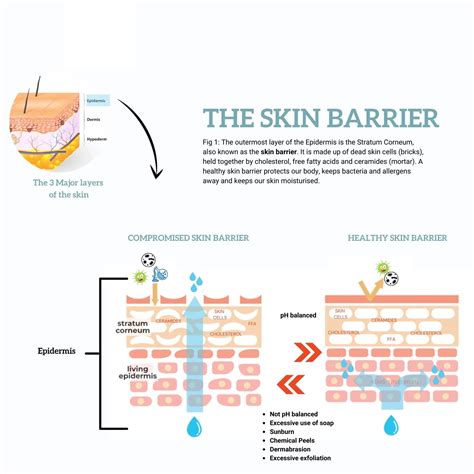 Infographic explaining the function of the skin barrier and why it needs special care in babies.
