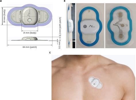 Visual representation of different medical devices and wearables (e.g., ECG patches, continuous glucose monitors, wound dressings) secured with various types of skin-safe adhesives.