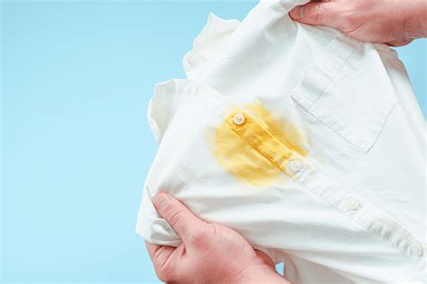 close-up of dish soap being applied to a yellow stain on fabric