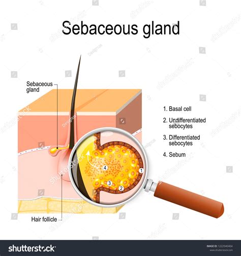 Diagram illustrating the anatomy of a healed piercing canal and sebaceous glands.