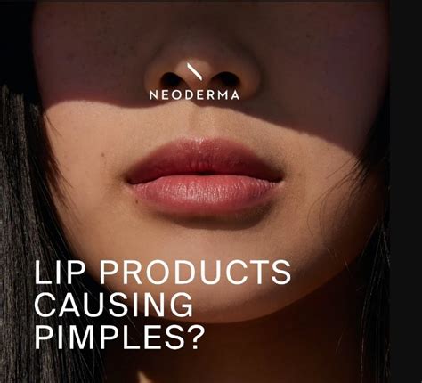 Visual guide to selecting non-comedogenic lip products and practicing good lip hygiene.