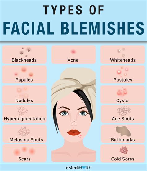 Illustration showing different types of skin blemishes and their common causes.