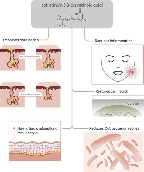 Diagram showing the mechanism of action of isotretinoin on sebaceous glands