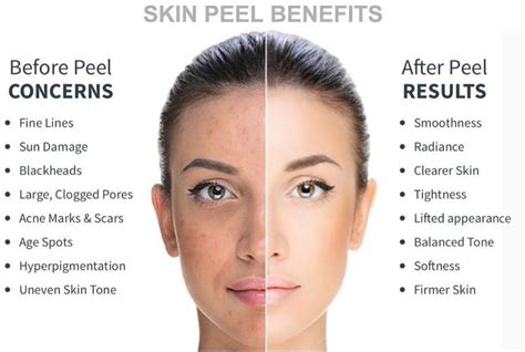 Before and after photos of cosmetic dermatology treatments like Botox and chemical peels