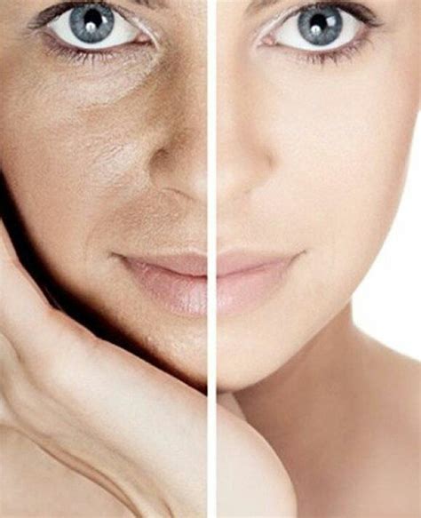 A split image showing a close-up of dry, textured skin on one side and smooth, hydrated skin with foundation on the other.
