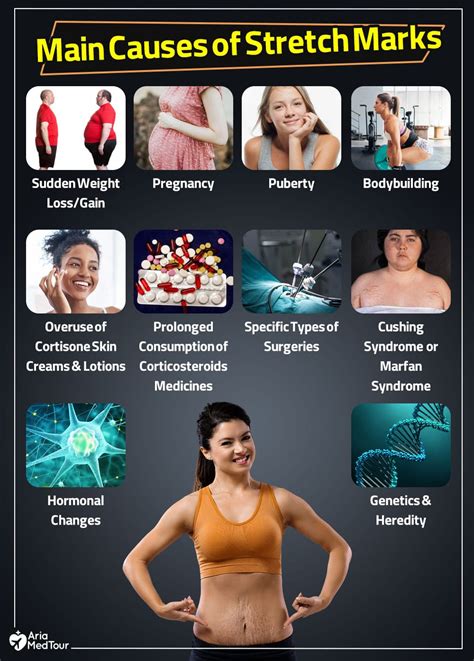 Infographic illustrating common causes of stretch marks: puberty, pregnancy, weight changes, bodybuilding, and steroid use.