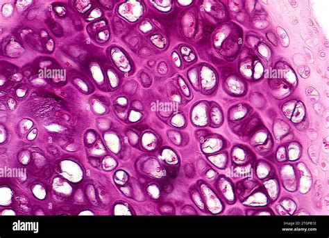 Histological image of hyaline cartilage showing chondrocytes within lacunae embedded in a glassy matrix.