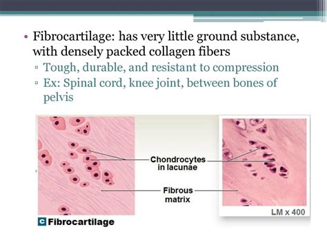 Micrograph of fibrocartilage, highlighting the dense collagen fibers and embedded chondrocytes.