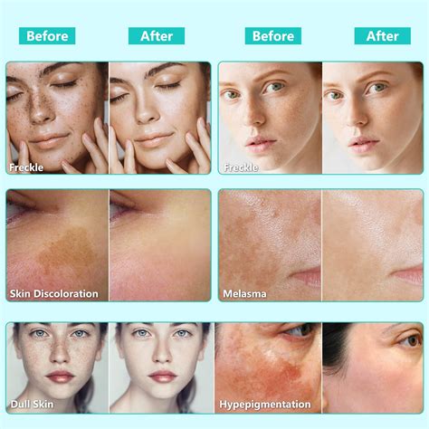 Infographic showing the transformation of dull skin to bright and smooth skin after using Daily Microfoliant.
