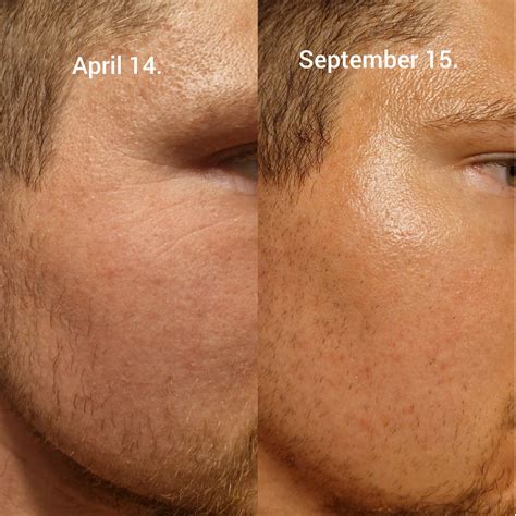 A visual comparison showing 