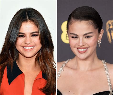 Side-by-side comparison of Selena Gomez's facial features from different periods of her career.