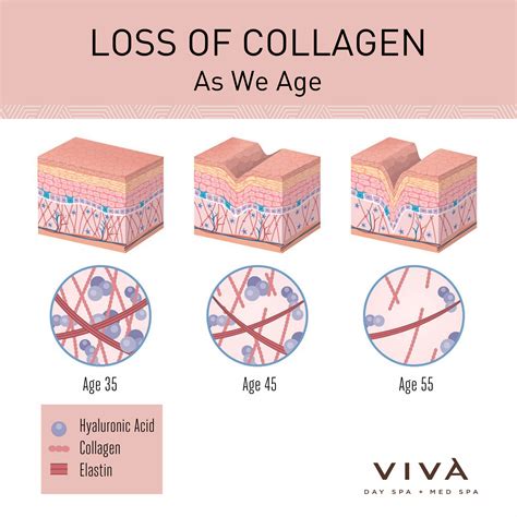 A diagram illustrating the process of collagen loss with age and how Sculptra stimulates new collagen production.