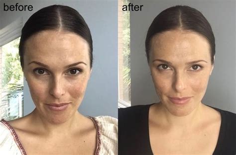 Collage of customer testimonials and before-and-after photos related to True Botanicals products.